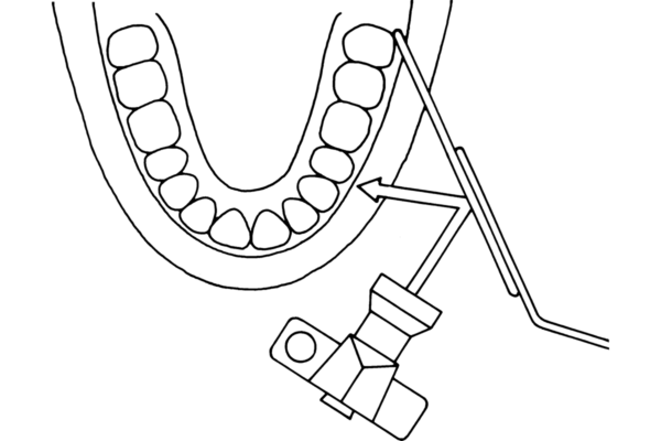 Intraoral mirror for lateral photographs